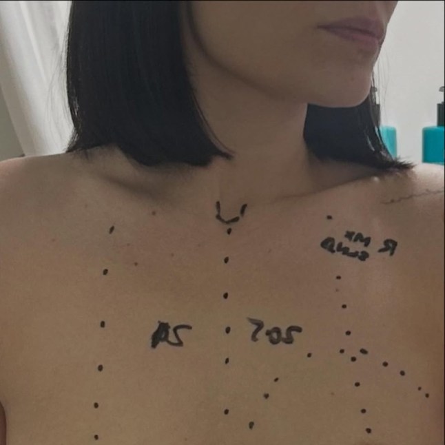 Jessie J shares update with a trigger warning after breast cancer operation jessiej 16m ??Blood warning??This post is some of the honest lows and highs of the last 48 hours. I will always show the good and hard bits of any journey I go through. Grateful to my doctor / surgeon and all the nurses who cared for me and all my family / friends who came to visit. ?? I am home now, to rest and wait for my results ???? Chanan is in a nurse outfit. No no, he isn?t, but funny to imagine. Still hugging everyone going through something tough right now. We all got this! ??????