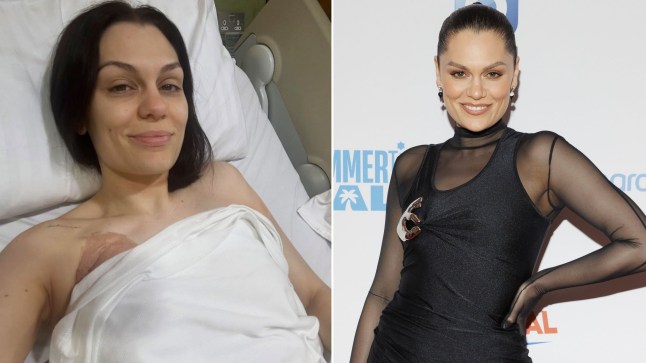 Jessie J compilation picture shows her in hospital bed on left and dressed up for an event in a black dress on right.